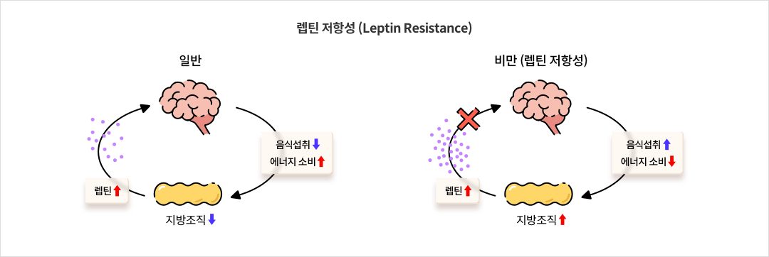13_6_mz_img_04.png 렙틴 저항성