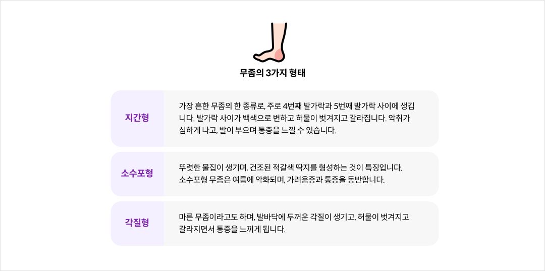 mgz_athletesfoot_img2_pc.png 무좀의 3가지 형태