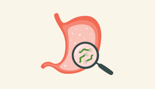mgz_helicobacter_img1_pc.png 헬리코박터균 관련 이미지