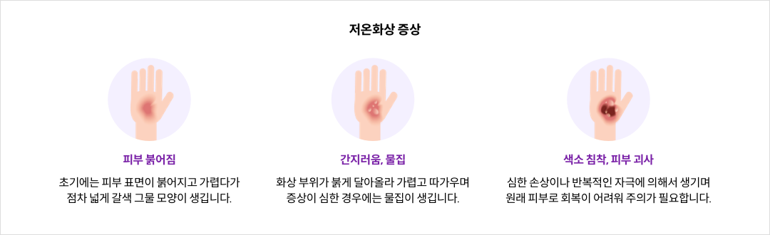 mgz_lowtemperatureburn_img2_pc.png 저온화상 증상 이미지