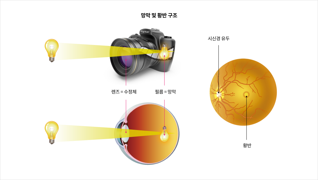 mgz_maculardegeneration_img2_pc.png 망막 및 황반 구조
