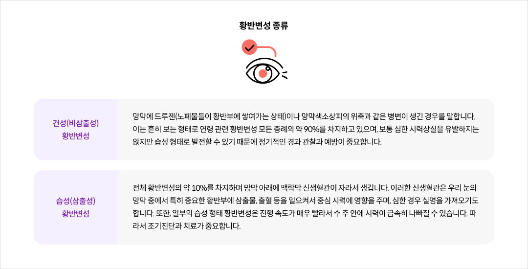 mgz_maculardegeneration_img3_pc.png 황반변성의 종류