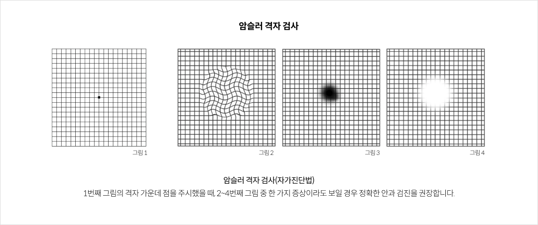 mgz_maculardegeneration_img5_pc.png 암슬러 격자 검사