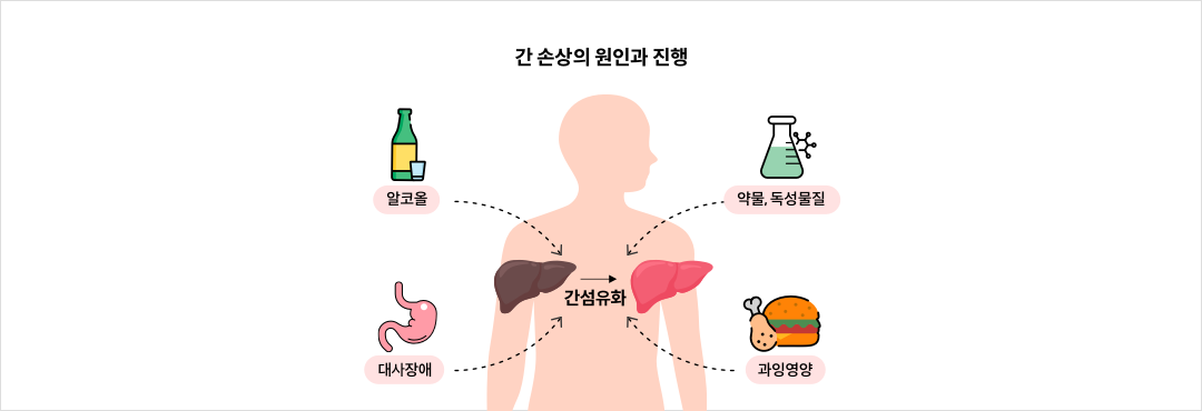 간 손상의 원인과 진행