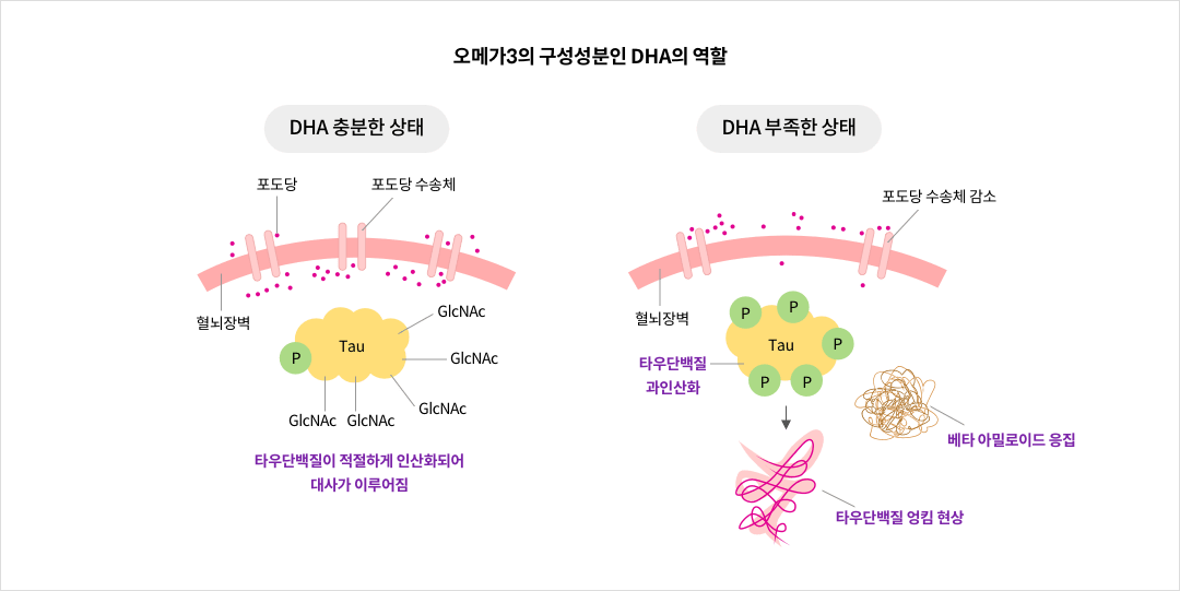 오메가3의 구성성분인 DHA의 역할