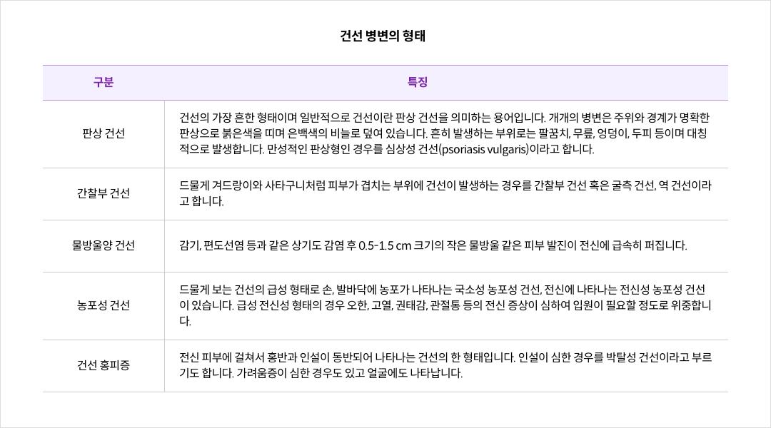 mgz_psoriasis_img2_pc.png 건선 병변의 형태