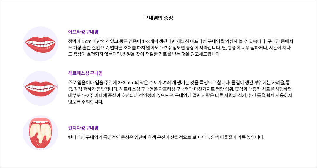 mgz_stomatitis_img3_pc.png 구내염의 증상