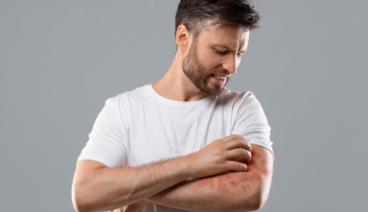 mgz_sunallergy_img1_pc.png 햇빛 알레르기 이미지