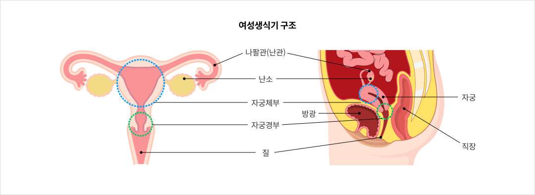 mgz_vaginitis_img1_pc.png 여성생식기 구조